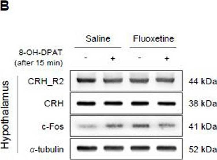 Western Blot CRHR2/CRF2 Antibody - BSA Free