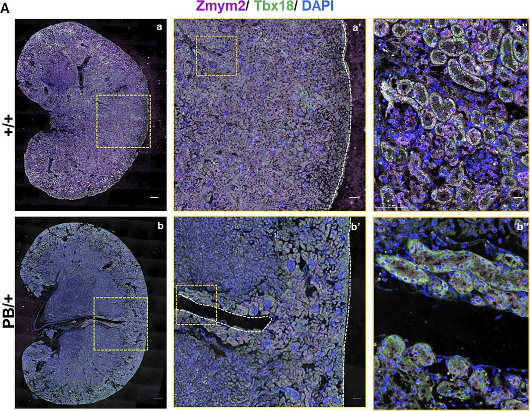 Immunocytochemistry/ Immunofluorescence ZNF198 Antibody - BSA Free