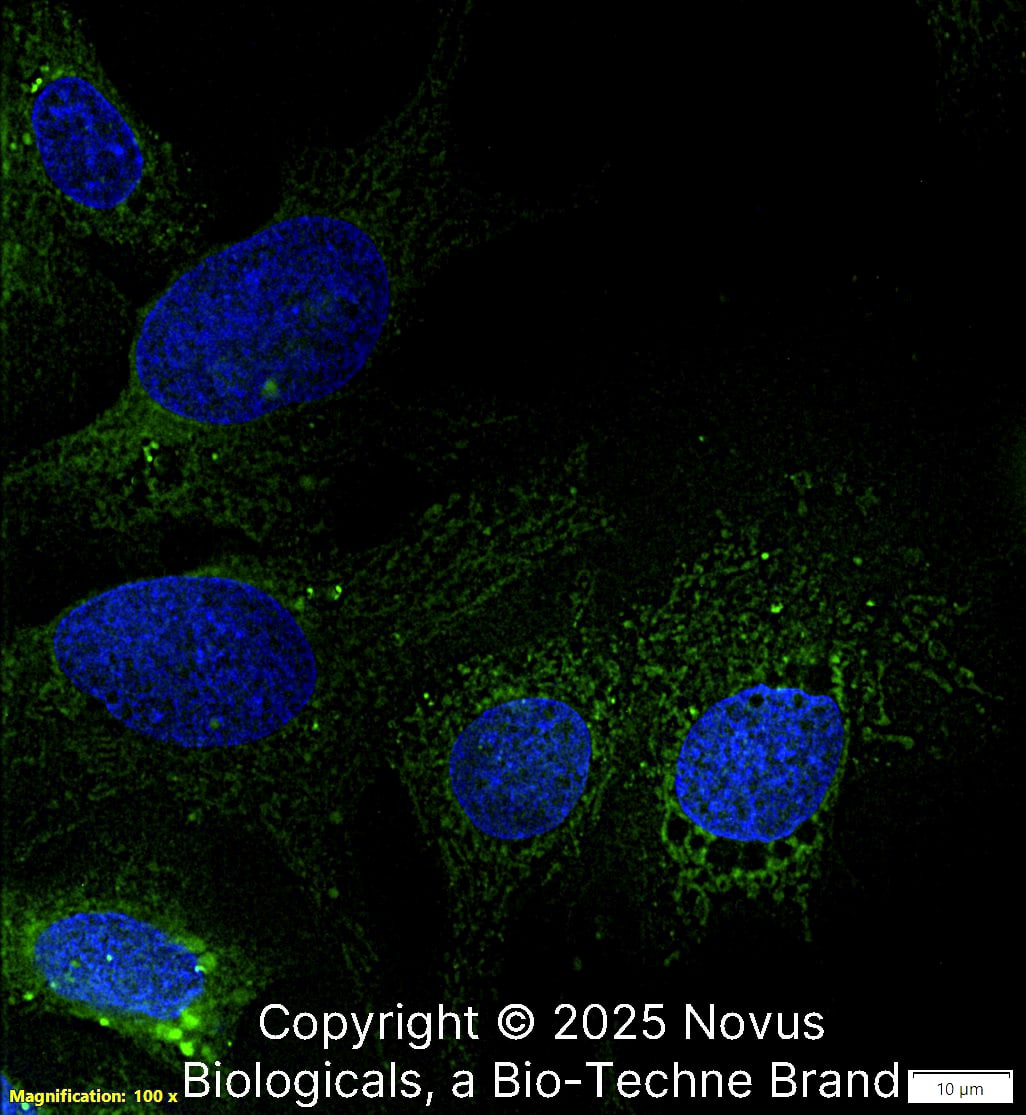 IkB-alpha Antibody (6A920) was detected in immersion fixed HepG2 human hepatocellular carcinoma cell line using Mouse anti-IkB-alpha Antibody (6A920) Protein G Purified Monoclonal Antibody conjugated to FITC (Catalog # NB100-56507F) (green) at 10 µg/mL overnight at 4C. Cells were counterstained with DAPI (blue). Cells were imaged using a 100X objective and digitally deconvolved.  