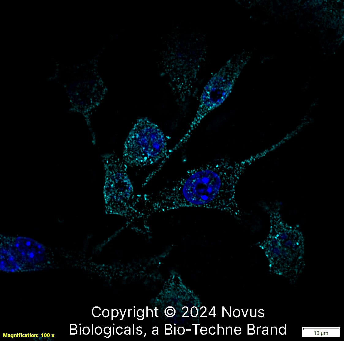 RANK/TNFRSF11A (9A725) was detected in immersion fixed Raw 264.7 mouse macrophage cell line using Mouse anti-RANK/TNFRSF11A (9A725) Protein-G purified Monoclonal Antibody conjugated to Alexa Fluor® 647 (Catalog # NB100-56508AF647) (light blue) at 10 µg/mL overnight at 4C. Cells were counterstained with DAPI (blue). Cells were imaged using a 100X objective and digitally deconvolved.    