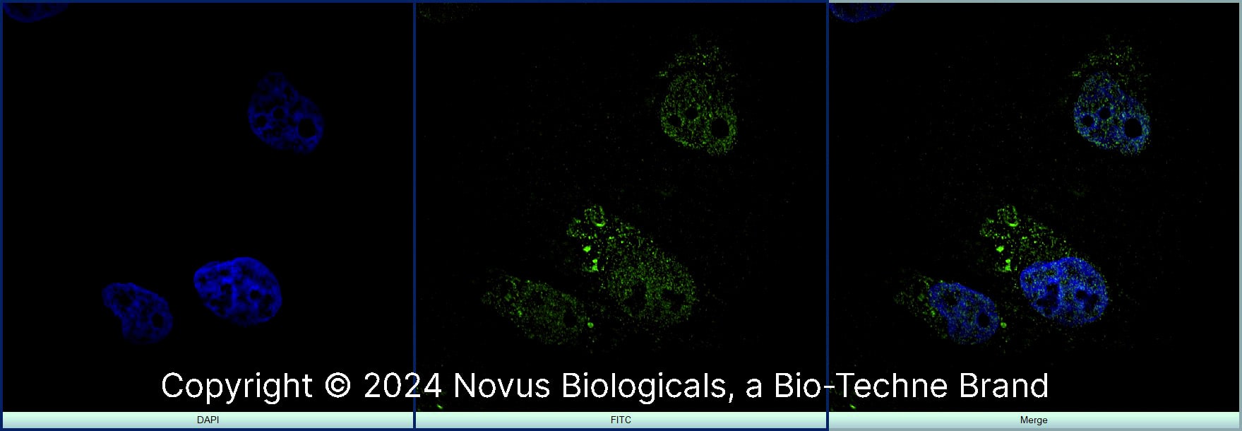 MyoD (5.8A) was detected in immersion fixed SJCRH30 human Rhabdomyosarcoma cell line with Mouse anti-MyoD (5.8A) Protein-G purified Monoclonal Antibody conjugated to Alexa Fluor® 488 (Catalog # NB100-56511AF488) (green) at 10 µg/mL overnight at 4C. Cells were counterstained with DAPI (dark blue). Cells were imaged using a 100X objective and digitally deconvolved.