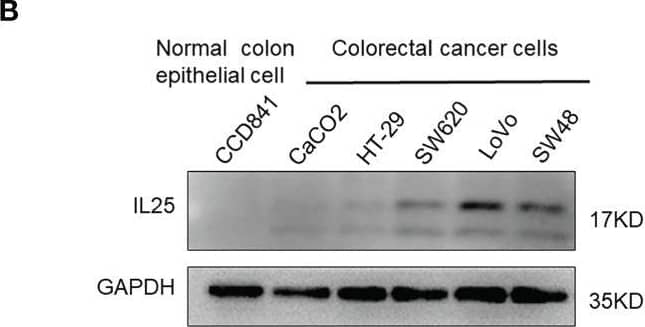 Western Blot: IL-17E/IL-25 Antibody (68C1039.2) - BSA Free [NB100-56541] - IL25 upregulated GLI1 by inhibiting p-AMPK. (A) HT-29 cells were treated with cycloheximide (CHX, 50 μg/ml) for the indicated time, & cell lysates were analyzed by Western blotting with the indicated antibodies. (B) Western blotting of p-AMPK & AMPK in the WT & IL25KO AOM/DSS-induced tumor tissue. (C) The expression levels of GLI1, p-AMPK, & AMPK were examined in HT-29 & SW620 cells treated with recombinant IL25 in a time-dependent manner by Western blotting. (D, E) Western blotting of GLI1, p-AMPK, & AMPK in SW620 cells treated with AMPK activator A769662 & Metformin following IL25 treatment. (F) GLI1 expression was detected by immunofluorescence staining in SW620 cells treated with AMPK activator Metformin following IL25 treatment. (G) SW620 cells were treated with 10 μM MG132 & then incubated with or without 50 ng/ml recombinant IL25 & 1 mM Metformin, then immunoprecipitated with GLI1 antibody. GLI1 ubiquitination was determined using an anti-ubiquitin antibody. IP, immunoprecipitation. (H) Sphere formation analysis of SW620 cells treated with AMPK activator Metformin following IL25 treatment. Representative images (left) & the mean numbers & sphere size (right) of spheres are shown. Data present as mean ± SEM; *p 6. The patients with CRC were divided into 2 groups according to the intra-tumor IL25 IHC-score: low group (n = 34), high group (n = 15). (E) Representative images of IL25 IHC staining from WT colon & AOM/DSS induced tumors on weeks 10 & 16 (down). Statistical analysis of IL25 staining in con colon, adjacent tissues, & AOM/DSS-induced CRC tissues (up). Data present as mean ± SEM; *p 6. The patients with CRC were divided into 2 groups according to the intra-tumor IL25 IHC-score: low group (n = 34), high group (n = 15). (E) Representative images of IL25 IHC staining from WT colon & AOM/DSS induced tumors on weeks 10 & 16 (down). Statistical analysis of IL25 staining in con colon, adjacent tissues, & AOM/DSS-induced CRC tissues (up). Data present as mean ± SEM; *p 6. The patients with CRC were divided into 2 groups according to the intra-tumor IL25 IHC-score: low group (n = 34), high group (n = 15). (E) Representative images of IL25 IHC staining from WT colon & AOM/DSS induced tumors on weeks 10 & 16 (down). Statistical analysis of IL25 staining in con colon, adjacent tissues, & AOM/DSS-induced CRC tissues (up). Data present as mean ± SEM; *p < 0.05, **p < 0.01, ***p < 0.001. Image collected & cropped by CiteAb from the following publication (//pubmed.ncbi.nlm.nih.gov/35359953), licensed under a CC-BY license. Not internally tested by Novus Biologicals.
