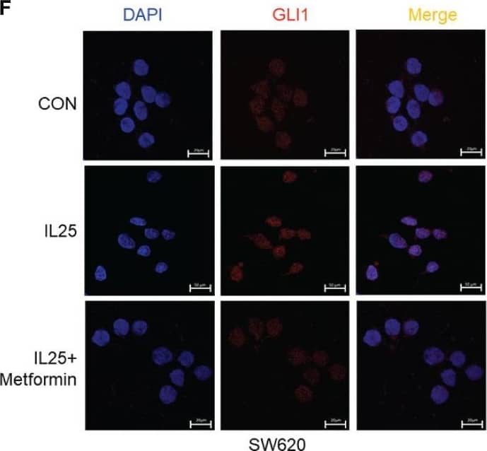 Immunohistochemistry: IL-17E/IL-25 Antibody (68C1039.2) - BSA Free [NB100-56541] - IL25 upregulated GLI1 by inhibiting p-AMPK. (A) HT-29 cells were treated with cycloheximide (CHX, 50 μg/ml) for the indicated time, & cell lysates were analyzed by Western blotting with the indicated antibodies. (B) Western blotting of p-AMPK & AMPK in the WT & IL25KO AOM/DSS-induced tumor tissue. (C) The expression levels of GLI1, p-AMPK, & AMPK were examined in HT-29 & SW620 cells treated with recombinant IL25 in a time-dependent manner by Western blotting. (D, E) Western blotting of GLI1, p-AMPK, & AMPK in SW620 cells treated with AMPK activator A769662 & Metformin following IL25 treatment. (F) GLI1 expression was detected by immunofluorescence staining in SW620 cells treated with AMPK activator Metformin following IL25 treatment. (G) SW620 cells were treated with 10 μM MG132 & then incubated with or without 50 ng/ml recombinant IL25 & 1 mM Metformin, then immunoprecipitated with GLI1 antibody. GLI1 ubiquitination was determined using an anti-ubiquitin antibody. IP, immunoprecipitation. (H) Sphere formation analysis of SW620 cells treated with AMPK activator Metformin following IL25 treatment. Representative images (left) & the mean numbers & sphere size (right) of spheres are shown. Data present as mean ± SEM; *p <0.05, **p <0.01, ***p <0.001. Image collected & cropped by CiteAb from the following publication (//pubmed.ncbi.nlm.nih.gov/35359953), licensed under a CC-BY license. Not internally tested by Novus Biologicals.