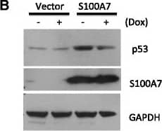 Western Blot: S100A7/Psoriasin Antibody (47C1068) - BSA Free [NB100-56559] - S100A7 activated p53 related anti-proliferative pathways. (A) Log2 fold change of mRNA expression of p53 pathway factors after S100A7 overexpression. (B) WB of p53 & S100A7 in MCF7-p53-CKD transfected with S100A7 or vector control. p53 shRNA transcription & p53 knockdown in MCF7-p53-CKD was induced by Doxycyclin (Dox). (C) S100A7 activated p53, ATR, chk-1, chk-2 in MCF7 cells. Image collected & cropped by CiteAb from the following publication (//pubmed.ncbi.nlm.nih.gov/25622979), licensed under a CC-BY license. Not internally tested by Novus Biologicals.