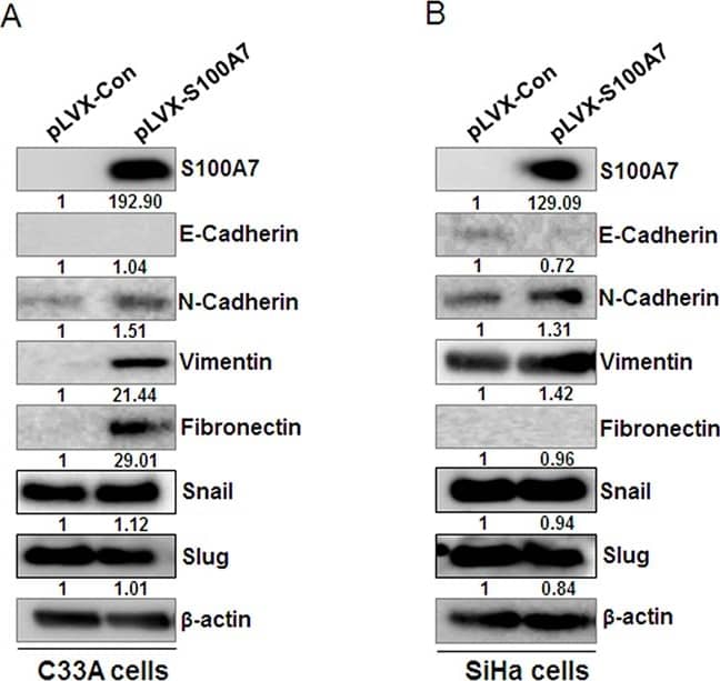 Western Blot: S100A7/Psoriasin Antibody (47C1068) - BSA Free [NB100-56559] - S100A7 induces EMT in cervical cancer cellsWestern Blot showed the protein level of epithelial marker E-cadherin & mesenchymal markers (N-Cadherin, Vimentin, Fibronectin) & EMT transcription factors Snail & Slug after overexpression of S100A7 in C33A cells A. & SiHa cells B.  beta -actin is used as a loading control. Image collected & cropped by CiteAb from the following publication (//www.oncotarget.com/lookup/doi/10.18632/oncotarget.15329), licensed under a CC-BY license. Not internally tested by Novus Biologicals.