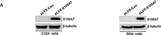 Western Blot: S100A7/Psoriasin Antibody (47C1068) - BSA Free [NB100-56559] - S100A7 is secreted & acts as a chemotactic factor of cell migration & invasionA. Cells were cultured in serum-free medium for 2 days, then the medium was collected, fractioned, followed by Western Blot analysis. B&C. Transwell migration & Matrigel invasion assays were performed in C33A & SiHa cells. Cell suspension was placed into the upper chamber in 0.1 ml of DMEM serum-free medium, & conditioned medium from S100A7-overexpressed C33A & SiHa cells & their corresponding control cells was placed in the lower chamber as a chemoattractant. The stained cells were manually counted from 4 randomly selected fields & normalized with cell proliferation [2-sided t test; *P < 0.05; ***P < 0.001]. Representative image & quantitative results of cell migration & invasion were shown (B. C33A cells; C. SiHa cells; ×10, bars:100μm). Image collected & cropped by CiteAb from the following publication (//www.oncotarget.com/lookup/doi/10.18632/oncotarget.15329), licensed under a CC-BY license. Not internally tested by Novus Biologicals.