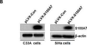 Western Blot: S100A7/Psoriasin Antibody (47C1068) - BSA Free [NB100-56559] - S100A7 promotes cervical cancer cell migration & invasionA&B. Establishment of stable cell lines of ectopic expression of S100A7. C33A & SiHa cells were infected with pLVX-Con & pLVX-S100A7 lentivirus, stable cells were established by Geneticin (G418) selection for about 2 weeks. Cells were harvested, S100A7 expression was detected by qRT-PCR (A: [mean (n=2) ± SD; 2-sided t test; ** P<0.01, normalized to  beta -actin]) & Western Blot. C&D. Transwell migration & Matrigel invasion assays were performed in S100A7-overexpressed cells & their corresponding control cells. The stained cells were manually counted from 4 randomly selected fields & normalized with cell proliferation [2-sided t test; **P < 0.01]. Representative image & quantitative results of cell migration & invasion were shown (C. C33A cells; D. SiHa cells; ×10, bars:100μm). E. The effect of S100A7 on cell migration was examined in wound-healing assay. Confluent cells were scratched & photographed at time 0h & 48h (Left panel. C33A cells; Right panel. SiHa cells. ×10, bars:100μm). Image collected & cropped by CiteAb from the following publication (//www.oncotarget.com/lookup/doi/10.18632/oncotarget.15329), licensed under a CC-BY license. Not internally tested by Novus Biologicals.