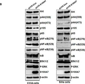 Western Blot: S100A7/Psoriasin Antibody (47C1068) - BSA Free [NB100-56559] - S100A7 interacts with RAGE, stimulates ERK pathway & RAGE mediates S100A7-induced migration & invasion in C33A & SiHa cellsA. HEK293 cells were transiently co-expressed with pcDNA3-Flag & pcDNA3-Flag-RAGE with pcDNA3-myc-S100A7. Cell extracts were immunoprecipitated separately with specific antibody against Flag, & the associated Flag-RAGE & myc-S100A7 were examined by Western blotting using tagged antibodies, respectively. B. S100A7-expressing cells were found to have higher levels of phospho-ERK (without any change in total ERK levels). In comparison, the levels of phospho-Akt & phospho-NF-kappa B had no obvious change. C. qRT-PCR verification of RAGE knockdown by two independent siRNAs in C33A & SiHa cells. D&E. RAGE knockdown suppressed migration & invasion in S100A7-overexpressed C33A & SiHa cells & their corresponding control cells. The stained cells were manually counted from 4 randomly selected fields & normalized with cell proliferation [2-sided t test; * P < 0.05; **P < 0.01]. Representative image & quantitative results of cell migration & invasion were shown (D. C33A cells; E. SiHa cells; ×10, bars: 100μm). Image collected & cropped by CiteAb from the following publication (//www.oncotarget.com/lookup/doi/10.18632/oncotarget.15329), licensed under a CC-BY license. Not internally tested by Novus Biologicals.