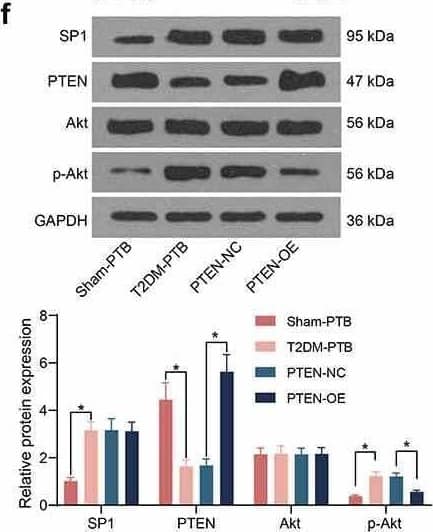 SP1/PTEN mediates lung infection in mice and the activity of the Akt signaling pathway. A, survival days of the mice after si-SP1 and si-PTEN administration (p < 0.01, the Kaplan-Meier analysis); B, bacterial load in murine lung tissues examined by CFU analysis (*p < 0.05, the one-way ANOVA); C, infiltration of inflammatory cells in murine lung tissues examined by HE staining (*p < 0.05, the one-way ANOVA); D, epithelial cell apoptosis in the murine lung tissues after Mtb infection examined by the TUNEL assay (*p < 0.05, the one-way ANOVA); E, fibrosis in murine lung tissues determined by Masson’s trichrome staining (*p < 0.05, the one-way ANOVA); F-G, protein levels of SP1 and PTEN and the Akt phosphorylation in murine lung tissues determined by western blot analysis (*p < 0.05, the one-way ANOVA). For animal studies, n = 6 in each group. Image collected and cropped by CiteAb from the following open publication (//pubmed.ncbi.nlm.nih.gov/35420971), licensed under a CC-BY license. Not internally tested by Novus Biologicals.