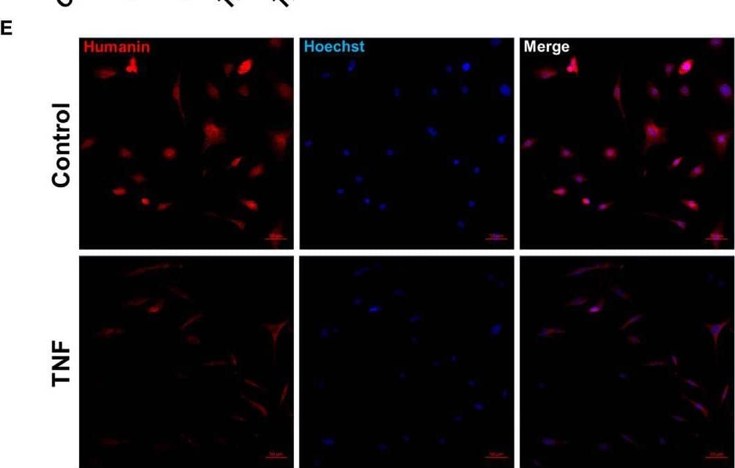 TNF suppressed humanin expression in human growth plate tissue specimens (n=6) obtained from 2 children or human chondrocytes. (A, B) Quantitative analysis of humanin staining (yellow arrows), calculated as number of positive cells per mm2. (C) Relative expression of humanin assessed by qPCR in HCS-2/8 cell line treated for 72 hours with TNF at 10, 30,100, 300 ng/ml concentrations (n=3-4). (D) Quantification of humanin expression by immunofluorescence in HCS-2/8 cells treated with TNF (100 ng/ml). (E) Representative images of humanin staining (red) in HCS-2/8 cells treated with TNF and untreated controls. Error bars indicate mean +/- SE. Students t-test was used to analyze differences between groups. Image collected and cropped by CiteAb from the following open publication (//www.frontiersin.org/articles/10.3389/fendo.2023.1142310/full), licensed under a CC-BY license. Not internally tested by Novus Biologicals.