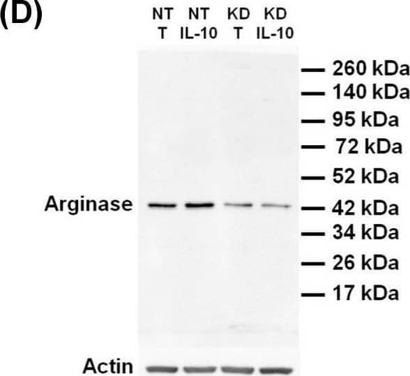 Under IL-10 treatment, PC1/3 KD cells exhibit lower levels of arginase than NT cells. NT and PC1/3 KD NR8383 macrophages were treated with 20 ng/mL of IL-10 for 24 h. (A) Western blot studies conducted with anti-iNOS. (B) Intensities of iNOS quantified and normalized to those of Actin. (C) Intensities of s-iNOS quantified and normalized to those of Actin. (D) Western blot studies conducted with anti-arginase. (E) Intensities of arginase quantified and normalized to those of Actin. The results are obtained from three independent experiments and depicted through graphic representations (means +/- SD). Data are analyzed by the Student t-test and values of p < 0.05 are considered statistically significant (*p-value of <0.05, **p-value of <0.01). Image collected and cropped by CiteAb from the following open publication (//pubmed.ncbi.nlm.nih.gov/31766635), licensed under a CC-BY license. Not internally tested by Novus Biologicals.