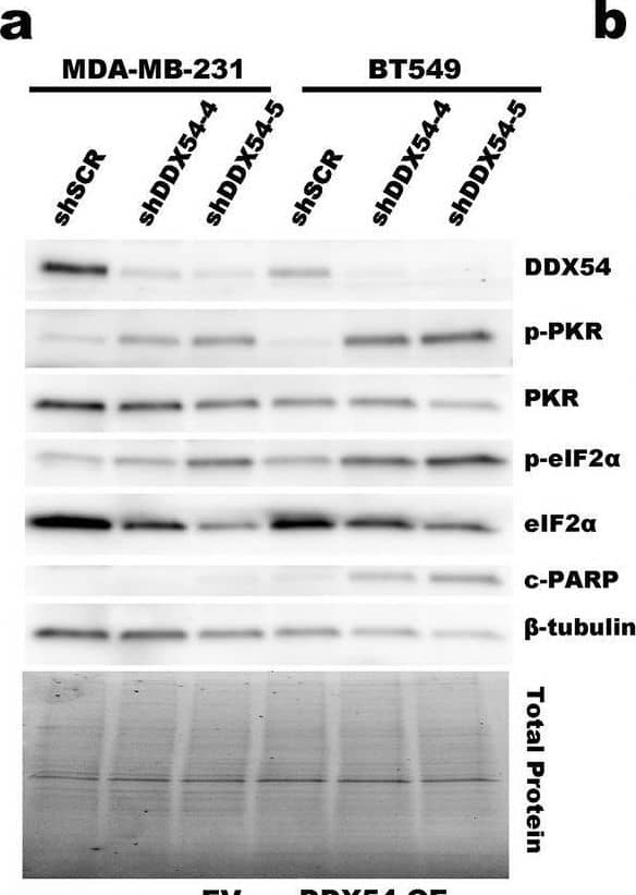 An shRNA targeting DDX54 causes activation of PKR. (a) Representative immunoblot of pPKR and other proteins of interest following knockdown of DDX54 by shDDX54-4 and shDDX54-5 (identical shRNA sequence) in MDA-MB-231 and BT549. Total protein was imaged using a Stain-Free Gel and was used for normalization. (b) Quantification of pPKR/PKR from the immunoblot in (a). See Supplemental Fig. 1 for quantification of other proteins of interest. (c) Quantification of foci formation shown in (d). (e) Representative immunoblot of pPKR and other proteins of interest following knockdown of DDX54 by shDDX54-4 in empty vector (EV) control MDA-MB-231 or DDX54 overexpressing (DDX54-OE) MDA-MB-231. (f) Cell proliferation as measured by counting viable cells by trypan blue exclusion. (g) Quantification of immunoblot in (e). (h) Representative immunoblot of pPKR and other proteins of interest following knockdown of DDX54 by shDDX54-4 in empty vector (EV) control BT549 or DDX54 overexpressing (DDX54-OE) BT549. (i) Quantification of immunoblot in (h). Bars or larger points represent the average of at least three replicates (shown as differently shaped points), error bars are +/- SD. *p < 0.05, **p < 0.01, ***p < 0.001. P-values determined by Dunnett’s test (b,c) or one-way ANOVA with post-hoc Tukey (g–i). Image collected and cropped by CiteAb from the following open publication (//pubmed.ncbi.nlm.nih.gov/39384561), licensed under a CC-BY license. Not internally tested by Novus Biologicals.