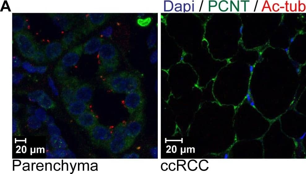 Immunofluorescent analysis of cilia in renal tissues. (A) Sections (4 μm) of renal parenchymal tissues and tumor tissues were stained with DAPI, acetylated-alpha -tubulin (Ac-tub) and pericentrin (PCNT) to mark cell nuclei and cilia. Presented images are maximal projections of confocal images of typical parenchymal tissue and a representative ccRCC. Scale bars 20 μm. (B) Normalized cilia frequencies of renal tumors, shown are paired quantifications of n = 20 samples. The plot compares the two cilia quantification methodologies described; data was obtained by immunofluorescent (IF) confocal image acquisition or scoring of immunohistochemical (IHC) stained sections. Statistics were determined by performing a paired t-test at a 95% confidence interval. Image collected and cropped by CiteAb from the following open publication (//pubmed.ncbi.nlm.nih.gov/23369289), licensed under a CC-BY license. Not internally tested by Novus Biologicals.