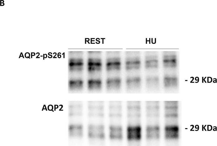 Western Blot Aquaporin-2 [p Ser261] Antibody - Azide Free
