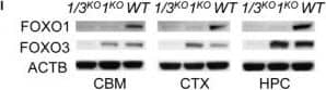 Western Blot: FOXO3 Antibody [NB100-614] - Expression of FOXO increases in aging brain. (a) XY plots of FOXO1 or FOXO3 mRNA expression within the noted brain regions vs. age of the subjects at time of death. (b) Pearson correlation coefficients (r) & p‐values for the correlation of FOXO1 or FOXO3 mRNA expression in various regions of the human brain with the age. (c) The mRNA expressions of FOXO1 & FOXO3 were measured in human cerebellums (n = 33). Blue & green dots indicate samples used for WB in (d). The mRNA (e) & protein (f) expression of Foxo1, Foxo3, & phospho‐T24/32 Foxo1/3 in young (<3‐month, n = 6), adult (3‐18‐month, n = 6), & old (18–20‐month, n = 6) FVB/B6 mixed‐strain mouse cerebellums is shown. Each dot represents individual animal. Error bars, mean ± SEM. *p < .05; **p < .01; ***p < .005. Statistical significance was determined by unpaired t‐test. (g) FOXO1 IHC analysis of brain sections of WT & Foxo 1/3/4 KO mice. Residual FOXO1 immunoreactivity in KO mice is visible in endothelial cells (inset). Scale bar = 200 μm. (h) RT‐qPCR results for Foxo1 & Foxo3 mRNA. Empty bars represent WT, & colored bars represent KO tissues (n = 4). (i) Representative Western blotting results. Foxo1‐ or Foxo1/3‐specific knockouts (1KO or 1/3KO) selectively lost targeted isoforms. CBM—cerebellum, STR—striatum, SCD—spinal cord, CTX—cortex, BST—brain stem, MDB—midbrain, HPC—hippocampus Image collected & cropped by CiteAb from the following publication (//pubmed.ncbi.nlm.nih.gov/29178390), licensed under a CC-BY license. Not internally tested by Novus Biologicals.