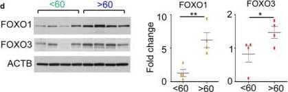 Western Blot: FOXO3 Antibody [NB100-614] - Expression of FOXO increases in aging brain. (a) XY plots of FOXO1 or FOXO3 mRNA expression within the noted brain regions vs. age of the subjects at time of death. (b) Pearson correlation coefficients (r) & p‐values for the correlation of FOXO1 or FOXO3 mRNA expression in various regions of the human brain with the age. (c) The mRNA expressions of FOXO1 & FOXO3 were measured in human cerebellums (n = 33). Blue & green dots indicate samples used for WB in (d). The mRNA (e) & protein (f) expression of Foxo1, Foxo3, & phospho‐T24/32 Foxo1/3 in young (<3‐month, n = 6), adult (3‐18‐month, n = 6), & old (18–20‐month, n = 6) FVB/B6 mixed‐strain mouse cerebellums is shown. Each dot represents individual animal. Error bars, mean ± SEM. *p < .05; **p < .01; ***p < .005. Statistical significance was determined by unpaired t‐test. (g) FOXO1 IHC analysis of brain sections of WT & Foxo 1/3/4 KO mice. Residual FOXO1 immunoreactivity in KO mice is visible in endothelial cells (inset). Scale bar = 200 μm. (h) RT‐qPCR results for Foxo1 & Foxo3 mRNA. Empty bars represent WT, & colored bars represent KO tissues (n = 4). (i) Representative Western blotting results. Foxo1‐ or Foxo1/3‐specific knockouts (1KO or 1/3KO) selectively lost targeted isoforms. CBM—cerebellum, STR—striatum, SCD—spinal cord, CTX—cortex, BST—brain stem, MDB—midbrain, HPC—hippocampus Image collected & cropped by CiteAb from the following publication (//pubmed.ncbi.nlm.nih.gov/29178390), licensed under a CC-BY license. Not internally tested by Novus Biologicals.