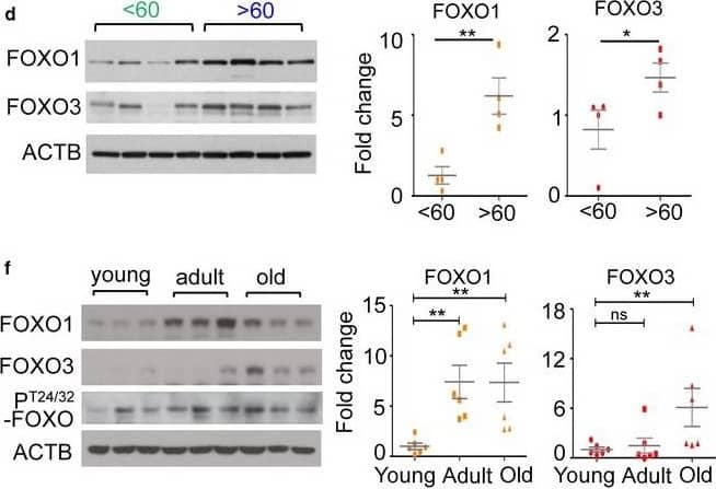 Western Blot: FOXO3 Antibody [NB100-614] - Expression of FOXO increases in aging brain. (a) XY plots of FOXO1 or FOXO3 mRNA expression within the noted brain regions vs. age of the subjects at time of death. (b) Pearson correlation coefficients (r) & p‐values for the correlation of FOXO1 or FOXO3 mRNA expression in various regions of the human brain with the age. (c) The mRNA expressions of FOXO1 & FOXO3 were measured in human cerebellums (n = 33). Blue & green dots indicate samples used for WB in (d). The mRNA (e) & protein (f) expression of Foxo1, Foxo3, & phospho‐T24/32 Foxo1/3 in young (<3‐month, n = 6), adult (3‐18‐month, n = 6), & old (18–20‐month, n = 6) FVB/B6 mixed‐strain mouse cerebellums is shown. Each dot represents individual animal. Error bars, mean ± SEM. *p < .05; **p < .01; ***p < .005. Statistical significance was determined by unpaired t‐test. (g) FOXO1 IHC analysis of brain sections of WT & Foxo 1/3/4 KO mice. Residual FOXO1 immunoreactivity in KO mice is visible in endothelial cells (inset). Scale bar = 200 μm. (h) RT‐qPCR results for Foxo1 & Foxo3 mRNA. Empty bars represent WT, & colored bars represent KO tissues (n = 4). (i) Representative Western blotting results. Foxo1‐ or Foxo1/3‐specific knockouts (1KO or 1/3KO) selectively lost targeted isoforms. CBM—cerebellum, STR—striatum, SCD—spinal cord, CTX—cortex, BST—brain stem, MDB—midbrain, HPC—hippocampus Image collected & cropped by CiteAb from the following publication (//pubmed.ncbi.nlm.nih.gov/29178390), licensed under a CC-BY license. Not internally tested by Novus Biologicals.