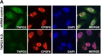 Immunocytochemistry/ Immunofluorescence: CPSF6 Antibody [NB100-61596] - Depletion of TNPO3 does not change the localization of CPSF6. (A) TNPO3 K.D. & shRNA control HeLa cells were fixed & stained using specific antibodies against CPSF6 (red), ASF/SF2 (red) & TNPO3 (green), as described in Methods. The nuclear compartment was labeled using DAPI. Image quantification is shown in Additional file 1. (B) TNPO3 K.D. & shRNA control HeLa cells were transiently transfected using constructs expressing FLAG-tagged CPSF6 or ASF/SF2. Twenty-four hours post-transfection cells were fixed & immunostained using anti-FLAG antibodies. The nuclear compartment was labeled using DAPI. Image quantification is shown in Additional file 2. Similar results were obtained in three independent experiments & a representative experiment is shown. Image collected & cropped by CiteAb from the following publication (//retrovirology.biomedcentral.com/articles/10.1186/1742-4690-10-46), licensed under a CC-BY license. Not internally tested by Novus Biologicals.