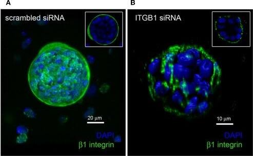 Quantification of knockdown of  beta 1 integrin in hS/PC microstructures. hS/PC microstructures formed in HA-based hydrogels and were transfected with scrambled siRNA or ITGB1 siRNA. Immunocytochemistry was used to determine  beta 1 integrin expression and spatial distribution of  beta 1 integrin 46 h post-transfection. Image analysis software was used to quantify  beta 1 integrin expression at microstructure surfaces from confocal micrographs and coverage indices were calculated for scrambled siRNA (A) and ITGB1 siRNA (B) groups where a 63% reduction in  beta 1 integrin expression at microstructure surfaces was quantified (C). Image collected and cropped by CiteAb from the following open publication (//pubmed.ncbi.nlm.nih.gov/31750298), licensed under a CC-BY license. Not internally tested by Novus Biologicals.