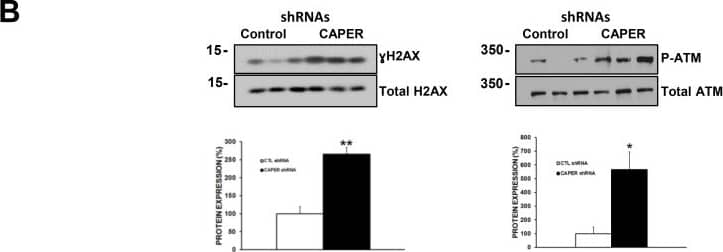 Western Blot: Histone H2AX Antibody [NB100-638] - Knockdown of CAPER induces DSB proteins ATM & H2AX & leads to apoptosis in MDA-MB-231 cells(A) H2AX phosphorylation on ser139 is significantly increased (upper right quadrant population) in MDA-MB-231 cells after CAPER knockdown as represented by Muse Cell Analyzer plots (3-fold, p < 0.001, n = 3). (B) The increase in  gamma H2AX was also validated through western blot analysis (2.5-fold, p < 0.01, n = 3). ATM phosphorylation on serine1981 is significantly upregulated after knockdown of CAPER expression (5-fold, p < 0.05, n = 3). (C) CAPER knockdown resulted in an increased level of caspase-3/7 activation through decreasing live cells (1.2-fold, p < 0.001, n = 3), while increasing apoptotic (7.5-fold, p < 0.001, n = 3), apoptotic/dead (6.5-fold, p < 0.001, n = 3), & dead (3-fold, p < 0.05, n = 3) cell populations. Interestingly, MDA-MB-231 cells expressing CAPER knockdown displayed no significant changes in any of the phases of the cell cycle (p = NS, n = 8, for G1, S & G2/M phases) compared to CTL shRNA (Figure 7C right panels). Image collected & cropped by CiteAb from the following publication (//pubmed.ncbi.nlm.nih.gov/30100993), licensed under a CC-BY license. Not internally tested by Novus Biologicals.