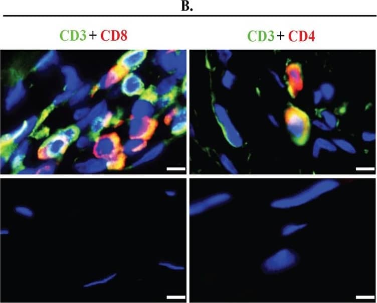 scAAV8G9-optHLA-G Combo Prevents Cornea Burn-induced Vascularization and Cytotoxic T-cell Infiltration. Rabbit cornea sections were acquired 60 days following the injection of indicated vectors into burn corneas and stained for an endothelial cell marker (CD31), T cell markers, transgene abundance, and  alpha SMA in the indicated treatment groups. Scale bars = (A) 10 um, (B) 5 um, (C) 20 um, (D) 200 um. Image collected and cropped by CiteAb from the following open publication (//pubmed.ncbi.nlm.nih.gov/29259248), licensed under a CC-BY license. Not internally tested by Novus Biologicals.