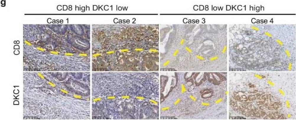 Immunohistochemistry DKC1 Antibody - BSA Free