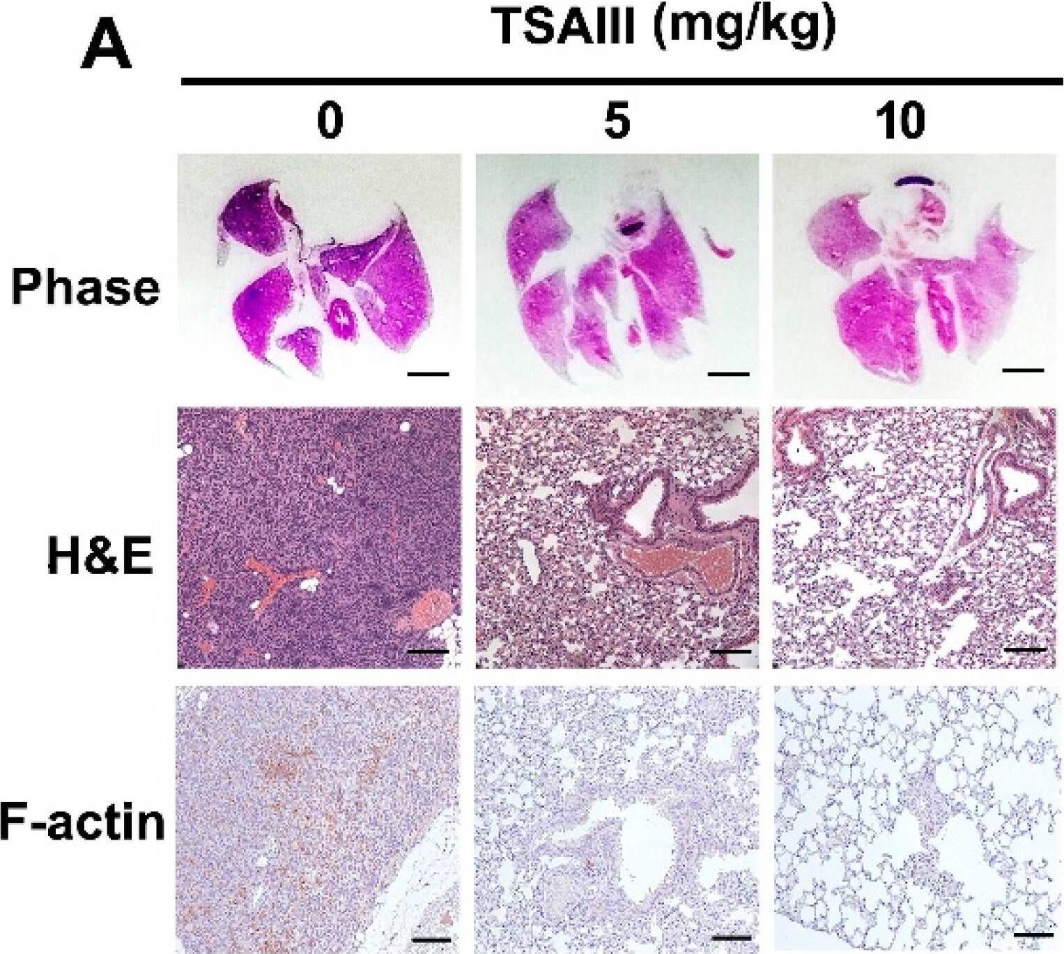 Immunohistochemistry Actin Gamma 1 Antibody (NH3) - BSA Free