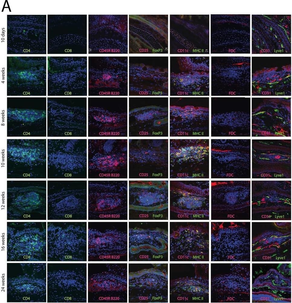 Development of CALT under SPF housing conditions.A) Immunhistological analysis of conjunctiva-associated lymphoid tissue (CALT). Mice aged 10 days until 24 weeks, kept under SPF housing conditions, were investigated using a panel of antibodies as described in table 1. Spatial distribution of lymphocytes, dendritic cells and follicular dendritic cells was analyzed. B) Schematic CALT development: 10 days after birth only CD4+ T-cells were sparsely present, followed by an influx of B-cells and formation of first follicles at 4 weeks of age. At 8 to 12 weeks CD8+ T-cells and CD4+CD25+ Tregs appeared, altogether forming a complex lymphoid follicle. After 16 weeks of age spatial organization diminished. C) CALT expression rate: CALT was not present at 10 days of age. 25% of the eyes at 4 weeks of age contained CALT, with a further increase to 43% CALT at 10 and 12 weeks of age. This was followed by a decrease to 31% at 16 weeks and an increased to 50% at 24 weeks of age. Numbers of follicles increased until 25% of the eyes contained 2 follicles at 12 weeks of age. At 24 weeks of age 25% of the eyes contained 3 follicles (n = number of eyes). Image collected and cropped by CiteAb from the following open publication (//pubmed.ncbi.nlm.nih.gov/24376530), licensed under a CC-BY license. Not internally tested by Novus Biologicals.