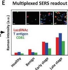 Principle of EV‐GLYPH assay for early‐stage NSCLC identification. A) Glycan signatures on sEVs derived from patients with benign and malignant lung diseases. B) CT and PET images of benign and malignant lung nodules. C) Working scheme of EV‐GLYPH assay. SEC‐purified sEVs from plasma are captured by anti‐MUC1 antibody immobilized on an electrode and subsequently labeled with SERS nanotags against LacdiNAc, T antigen, and CD81. D) A nanomixing fluid flow is generated on the electrode surface by the applied ac‐EHD field. E) With in situ SERS mapping, the average Raman intensities and false‐color SERS spectral images (insets) are established based on the characteristic Raman signals of three SERS nanotags (WFA‐MBA, 1075 cm−1, red; PNA‐TFMBA, 1375 cm−1, blue; anti‐CD81‐DTNB, 1335 cm−1, green), representing the expression of LacdiNAc, T antigen, and CD81, respectively. Image collected and cropped by CiteAb from the following open publication (//pubmed.ncbi.nlm.nih.gov/38885350), licensed under a CC-BY license. Not internally tested by Novus Biologicals.