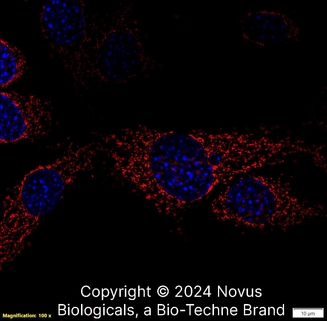 rRNA (Yb10) was detected in immersion fixed NIH3T3 Mouse fibroblast cell line using Mouse anti- rRNA (Yb10) Protein G Purified Monoclonal Antibody conjugated to Biotin (Catalog # NB100-662B) at 5 µg/mL overnight at 4C. Cells were stained using Streptavidin conjugated to DyLight 550 (red) and counterstained with DAPI (blue). Cells were imaged using a 100X objective and digitally deconvolved.  