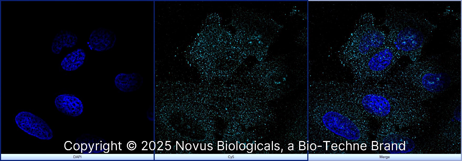rRNA (Yb10) was detected in immersion fixed U-2 OS human osteosarcoma cell line using Mouse anti- rRNA (Yb10) Protein G Purified Monoclonal Antibody conjugated to DyLight 650 (Catalog # NB100-662C) (light blue) at 10 µg/mL overnight at 4C. Cells were counterstained with DAPI (blue). Cells were imaged using a 100X objective and digitally deconvolved.  