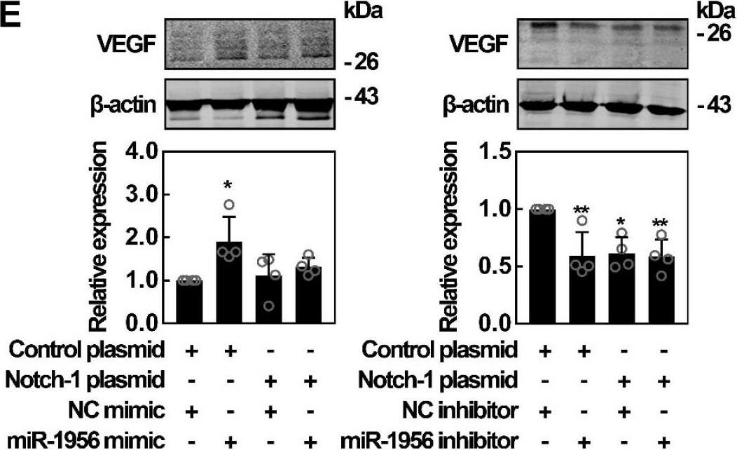 Western Blot: VEGF Antibody (VG1) - BSA Free [NB100-664] -  Notch-1 is identified as an intermediate molecule in the miR-1956-VEGF axis. (A) Notch-1 is a target gene for miR-1956. The sequence of miR-1956, the potential binding site at the 3' UTR of Notch-1 mRNA, & the nucleotides mutated in the Notch-1-3' UTR mutant are shown. HEK293 cells were transiently cotransfected with miR-1956 mimic or NC using luciferase reporter vectors. The luciferase activity was normalized to the activity of Renilla luciferase. Data are shown as mean ± SD from three independent experiments. *, significantly different from NC; **, p < 0.01. After transfection with 50 nmol/L of miR-1956 mimic for 3 days, the mRNA level of Notch-1 was determined using qRT-PCR (B), & the protein expression of Notch-1 was measured using western blotting (C). For B, data are shown as mean ± SD from three independent experiments. *, significantly different from control; **, p < 0.01. For C, representative images of two independent experiments are shown. Data are shown as mean ± SD. *, significantly different from control; **, p < 0.01. ADMSCs were transfected with 2.5 μg Notch-1 plasmid & 50 nmol/L miR-1956 mimic or 100 nmol/L miR-1956 inhibitor for 3 days, the intracellular expression of Notch-1 (D) & VEGF (E) was detected by western blotting. For D & E, representative images of four independent experiments are shown. Data are shown as mean ± SD. *, significantly different from the control group transfected with control plasmid & NC mimic or inhibitor; *, p < 0.01; **, p < 0.01. #, significantly different from the group transfected with Notch-1 plasmid & NC mimic or inhibitor; #, p < 0.05. One-way ANOVA followed by Tukey's post-test was performed (A-E). Image collected & cropped by CiteAb from the following publication (//pubmed.ncbi.nlm.nih.gov/31938051), licensed under a CC-BY license. Not internally tested by Novus Biologicals.