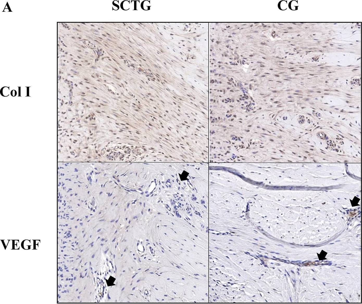 Comparison of Col I and VEGF expression. (A) Representative images of Col I and VEGF immunohistochemical staining (30× magnification). Col I was stained with a reddish color. The black arrows indicate the location of VEGF staining. (B) Quantification of Col I and VEGF expression by immunohistochemical staining (mean +/- SD). Image collected and cropped by CiteAb from the following open publication (//pubmed.ncbi.nlm.nih.gov/37151660), licensed under a CC-BY license. Not internally tested by Novus Biologicals.