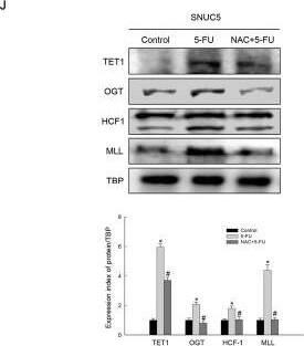 Western Blot: Host Cell Factor 1/HCFC1 Antibody [NB100-68209] - 5-FU-produced ROS involved in histone methyltransferase-mediated Nrf2 expression. J. Expression of TET1 & interaction proteins detected by WB analysis. *Significantly different from SNUC5 cells (p<0.05), & #significantly different from 5-FU-treated SNUC5 cells (p<0.05). Image collected & cropped by CiteAb from the following publication (//www.oncotarget.com/lookup/doi/10.18632/oncotarget.9745), licensed under a CC-BY license. Not internally tested by Novus Biologicals.