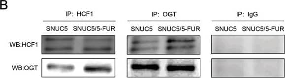 Western Blot: Host Cell Factor 1/HCFC1 Antibody [NB100-68209] - Involvement of OGT in histone methylase MLL/COMPASS-like complex-mediated Nrf2 expression in SNUC5/5-FUR cellsA. OGT & O-GlcNAc expression was determined by Western blotting. *Significantly different from SNUC5 cells (p<0.05). B. Interaction between HCF1 & OGT was examined by immunoprecipitation analysis using anti-HCF1 & anti-OGT antibodies followed by Western blotting with anti-HCF1 & anti-OGT antibodies. C. Interaction between HCF1 & OGT was assessed by using PLA. Each green spot represents for a single interaction (HCF1 & OGT) & DNA was stained with DAPI. *Significantly different from SNUC5 cells (p<0.05). D. Interaction between MLL & OGT was examined by immunoprecipitation analysis using anti-MLL & anti-OGT antibodies followed by Western blotting with anti-OGT & anti-MLL antibodies. E. Interaction between MLL & OGT was assessed by using PLA. Each green spot represents for a single interaction (MLL & OGT) & DNA was stained with DAPI. *Significantly different from SNUC5 cells (p<0.05). The cells were transfected with non-targeting siRNA (siControl) or siOGT RNA for 24 h. F. Expression pattern of MLL mRNA in SNUC5/5-FUR cells was determined by RT-PCR analysis. *Significantly different from siControl-transfected cells (p<0.05). G. Expression pattern of OGT, MLL, HFC1, & Nrf2 in SNUC5/5-FUR cells was determined by Western blot analysis. *Significantly different from siControl-transfected cells (p<0.05). Image collected & cropped by CiteAb from the following publication (//www.oncotarget.com/lookup/doi/10.18632/oncotarget.9745), licensed under a CC-BY license. Not internally tested by Novus Biologicals.