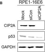 Western Blot: CIP2A Antibody [NB100-68264] - Inhibition of CIP2A by siRNA impeded cell viability & DNA synthesis in HPV‐16E6–expressing cells. A, Elevated expression of CIP2A protein in 16E6‐expressing RPE1 cells. B, Western blot analysis of CIP2A & p53 proteins after transfection with scrambled siRNA (siCon) or CIP2A siRNA (siCIP2A) for 48 h. A representative of 3 independent experiments is shown. C, Cell viability assay of RPE1‐16E6 cells with CIP2A knockdown. D, Representative flow cytometry of BrdU staining profiles is shown. E, The mean & SD of BrdU‐positive cells from 3 experiments are summarized. **, P < .01. Image collected & cropped by CiteAb from the following publication (//pubmed.ncbi.nlm.nih.gov/29893470), licensed under a CC-BY license. Not internally tested by Novus Biologicals.