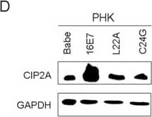 Western Blot: CIP2A Antibody [NB100-68264] - HPV-16E7 & -58E7 upregulated CIP2A mRNA & protein levels in PHKs(A) Western blot analysis of CIP2A protein level in PHKs expressing HPV-16E7, -58E7, -6E7; & (B) Quantification. (C) qRT-PCR analysis of CIP2A mRNA level in PHKs expressing HPV-16E7, -58E7, -6E7. (D) Western blot analysis of CIP2A protein level in PHKs expressing HPV-16E7 & 16E7 mutants L22A & C24G. Babe, vector control. *, P < 0.05; **, P < 0.01; & ***, P < 0.001. Image collected & cropped by CiteAb from the following publication (//pubmed.ncbi.nlm.nih.gov/25650660), licensed under a CC-BY license. Not internally tested by Novus Biologicals.