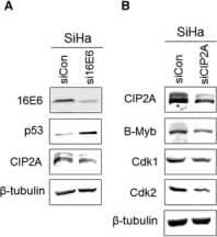 Western Blot: CIP2A Antibody [NB100-68264] - Inhibition of Cdk1 & Cdk2 by CIP2A knockdown in cervical cancer SiHa cells caused G1 arrest. A, Western blot analysis of 16E6, p53 & CIP2A after HPV‐16E6 knockdown in cervical cancer SiHa cells. B, Protein expression of CIP2A, B‐Myb, Cdk1 & Cdk2 in SiHa cells after CIP2A knockdown. Data from a representative of 3 experiments are shown. C, Flow cytometric analysis of SiHa cells with CIP2A knockdown treated with PBS or bleomycin. A representative flow cytometry of 3 independent experiments is shown. D, Quantification of percentages G1 phase cells. Data from 3 experiments are summarized. *, P < .05 Image collected & cropped by CiteAb from the following publication (//pubmed.ncbi.nlm.nih.gov/29893470), licensed under a CC-BY license. Not internally tested by Novus Biologicals.