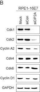 Western Blot: CIP2A Antibody [NB100-68264] - CIP2A siRNA knockdown caused G1 arrest & decreased Cdk1 & Cdk2 protein levels in E7-expressing cells(A) Flow cytometry of cells expressing 16E7 transfected with CIP2A siRNA for 48 hr, treated with DMSO control or bleomycin (10 μg/mL) for 24 hr, then stained with PI. G1, S & G2 phases are indicated. (B) Western blot analysis of Cdk1, Cdk2, Cyclin A2, Cdk4, Cdk6, Cyclin D1 protein levels in cells expressing HPV-16E7 transfected with CIP2A siRNA. Babe, vector control. Image collected & cropped by CiteAb from the following publication (//pubmed.ncbi.nlm.nih.gov/25650660), licensed under a CC-BY license. Not internally tested by Novus Biologicals.