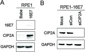 Western Blot: CIP2A Antibody [NB100-68264] - Knockdown of CIP2A inhibited cell proliferation & DNA synthesis of HPV-16E7-expressing cells(A) Western blot analysis of protein level of 16E7 & CIP2A in RPE1-16E7 cells & (B) with CIP2A siRNA for 48 hr. (C) CCK8 assay of cell proliferation of RPE1-16E7 cells with CIP2A siRNA. (D) Flow cytometry of cells with CIP2A siRNA & labeled with BrdU for 2 hr, then stained with PI & BrdU; & (E), Quantification. Babe, vector control. **, P < 0.01. Image collected & cropped by CiteAb from the following publication (//pubmed.ncbi.nlm.nih.gov/25650660), licensed under a CC-BY license. Not internally tested by Novus Biologicals.