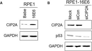 Western Blot: CIP2A Antibody [NB100-68264] - Inhibition of CIP2A by siRNA impeded cell viability & DNA synthesis in HPV‐16E6–expressing cells. A, Elevated expression of CIP2A protein in 16E6‐expressing RPE1 cells. B, Western blot analysis of CIP2A & p53 proteins after transfection with scrambled siRNA (siCon) or CIP2A siRNA (siCIP2A) for 48 h. A representative of 3 independent experiments is shown. C, Cell viability assay of RPE1‐16E6 cells with CIP2A knockdown. D, Representative flow cytometry of BrdU staining profiles is shown. E, The mean & SD of BrdU‐positive cells from 3 experiments are summarized. **, P < .01. Image collected & cropped by CiteAb from the following publication (//pubmed.ncbi.nlm.nih.gov/29893470), licensed under a CC-BY license. Not internally tested by Novus Biologicals.