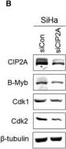 Western Blot: CIP2A Antibody [NB100-68264] - Inhibition of Cdk1 & Cdk2 by CIP2A knockdown in cervical cancer SiHa cells caused G1 arrest. A, Western blot analysis of 16E6, p53 & CIP2A after HPV‐16E6 knockdown in cervical cancer SiHa cells. B, Protein expression of CIP2A, B‐Myb, Cdk1 & Cdk2 in SiHa cells after CIP2A knockdown. Data from a representative of 3 experiments are shown. C, Flow cytometric analysis of SiHa cells with CIP2A knockdown treated with PBS or bleomycin. A representative flow cytometry of 3 independent experiments is shown. D, Quantification of percentages G1 phase cells. Data from 3 experiments are summarized. *, P < .05 Image collected & cropped by CiteAb from the following publication (//pubmed.ncbi.nlm.nih.gov/29893470), licensed under a CC-BY license. Not internally tested by Novus Biologicals.