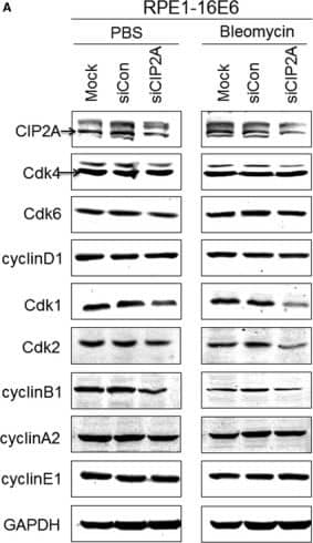 Western Blot: CIP2A Antibody [NB100-68264] - Silencing CIP2A caused decreased Cdk1 & Cdk2 proteins in 16E6‐expressing cells. A, Western blot analysis of CIP2A, Cdk4, Cdk6, cyclin D1, Cdk1, Cdk2, cyclin B1, cyclin A2 & cyclin E1 protein levels in cells expressing HPV‐16E6 transfected with CIP2A siRNA & then treated with PBS or 10 μg/mL bleomycin for 24 h. A representative of 3 independent experiments is shown. B, Quantification of all cell cycle‐related proteins. Data from 3 experiments are summarized. C, Relative mRNA levels of all cell cycle‐related genes determined by qRT‐PCR. Data from 3 experiments are summarized. *, P < .05; **, P < .01 Image collected & cropped by CiteAb from the following publication (//pubmed.ncbi.nlm.nih.gov/29893470), licensed under a CC-BY license. Not internally tested by Novus Biologicals.