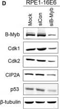 Western Blot: CIP2A Antibody [NB100-68264] - Regulation of Cdk1 & Cdk2 by CIP2A is dependent on B‐Myb rather than c‐Myc. A, Western blot analysis of CIP2A, c‐Myc, phospho‐S62‐Myc & B‐Myb protein levels in 16E6‐expressing cells after CIP2A knockdown.  beta ‐Tubulin was used as a loading control. B, Protein levels of B‐Myb, c‐Myc & phospho‐S62‐Myc in 16E6‐expressing PHKs & (C) RPE1 cells. D, Protein levels of B‐Myb, Cdk1 & Cdk2, CIP2A & p53 in 16E6‐expressing cells after B‐Myb knockdown with siRNA. Data from a representative of 3 experiments are shown. E, Knockdown of B‐Myb down‐regulates Cdk1 & Cdk2 luciferase reporter activities. RPE1 cells were cotransfected with the Cdk1 or Cdk2 promoter‐luciferase constructs & renilla luciferase control plasmid together with B‐Myb siRNA plasmid. Cells were harvested after 48 h, & lysates were assayed for luciferase activity. F, Flow cytometric analysis of 16E6‐expressing cells transfected with B‐Myb siRNA treated with PBS or bleomycin. G1, S & G2 phases are indicated. A representative flow cytometry of 3 independent experiments is shown. G, Quantification of percentages G1 phase cells. Data from 3 experiments are summarized. H, Western blot analysis of B‐Myb, Cdk1 & Cdk2 in B‐Myb–overexpressing CIP2A knockdown cells. Data from a representative of 3 experiments are shown. *, P < .05; ***, P < .001 Image collected & cropped by CiteAb from the following publication (//pubmed.ncbi.nlm.nih.gov/29893470), licensed under a CC-BY license. Not internally tested by Novus Biologicals.