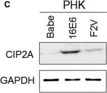 Western Blot: CIP2A Antibody [NB100-68264] - Induction of CIP2A mRNA & protein expression by HPV‐16E6 in PHKs. A, mRNA expression of HPV‐16E6 in PHKs expressing 16E6 & F2V using  beta ‐actin as a loading control. B, Protein levels of HPV‐16E6, p53 & p21 in PHKs expressing 16E6 & F2V. Expression of GAPDH was used as a loading control. A representative of 2 independent experiments is shown. C, HPV‐16E6 expression leads to increased protein expression of CIP2A in PHKs. Data from a representative of 3 experiments are shown. D, Data from 3 experiments are summarized. E, Relative CIP2A mRNA expression was determined by qRT‐PCR in the above cells. Data from 3 experiments are summarized. The mean & standard deviation (SD) of 3 independent experiments are shown. Babe, pBabe‐puromycin vector. *, P < .05; **, P < .01; & ***, P < .001 Image collected & cropped by CiteAb from the following publication (//pubmed.ncbi.nlm.nih.gov/29893470), licensed under a CC-BY license. Not internally tested by Novus Biologicals.