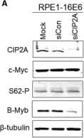 Western Blot: CIP2A Antibody [NB100-68264] - Regulation of Cdk1 & Cdk2 by CIP2A is dependent on B‐Myb rather than c‐Myc. A, Western blot analysis of CIP2A, c‐Myc, phospho‐S62‐Myc & B‐Myb protein levels in 16E6‐expressing cells after CIP2A knockdown.  beta ‐Tubulin was used as a loading control. B, Protein levels of B‐Myb, c‐Myc & phospho‐S62‐Myc in 16E6‐expressing PHKs & (C) RPE1 cells. D, Protein levels of B‐Myb, Cdk1 & Cdk2, CIP2A & p53 in 16E6‐expressing cells after B‐Myb knockdown with siRNA. Data from a representative of 3 experiments are shown. E, Knockdown of B‐Myb down‐regulates Cdk1 & Cdk2 luciferase reporter activities. RPE1 cells were cotransfected with the Cdk1 or Cdk2 promoter‐luciferase constructs & renilla luciferase control plasmid together with B‐Myb siRNA plasmid. Cells were harvested after 48 h, & lysates were assayed for luciferase activity. F, Flow cytometric analysis of 16E6‐expressing cells transfected with B‐Myb siRNA treated with PBS or bleomycin. G1, S & G2 phases are indicated. A representative flow cytometry of 3 independent experiments is shown. G, Quantification of percentages G1 phase cells. Data from 3 experiments are summarized. H, Western blot analysis of B‐Myb, Cdk1 & Cdk2 in B‐Myb–overexpressing CIP2A knockdown cells. Data from a representative of 3 experiments are shown. *, P < .05; ***, P < .001 Image collected & cropped by CiteAb from the following publication (//pubmed.ncbi.nlm.nih.gov/29893470), licensed under a CC-BY license. Not internally tested by Novus Biologicals.