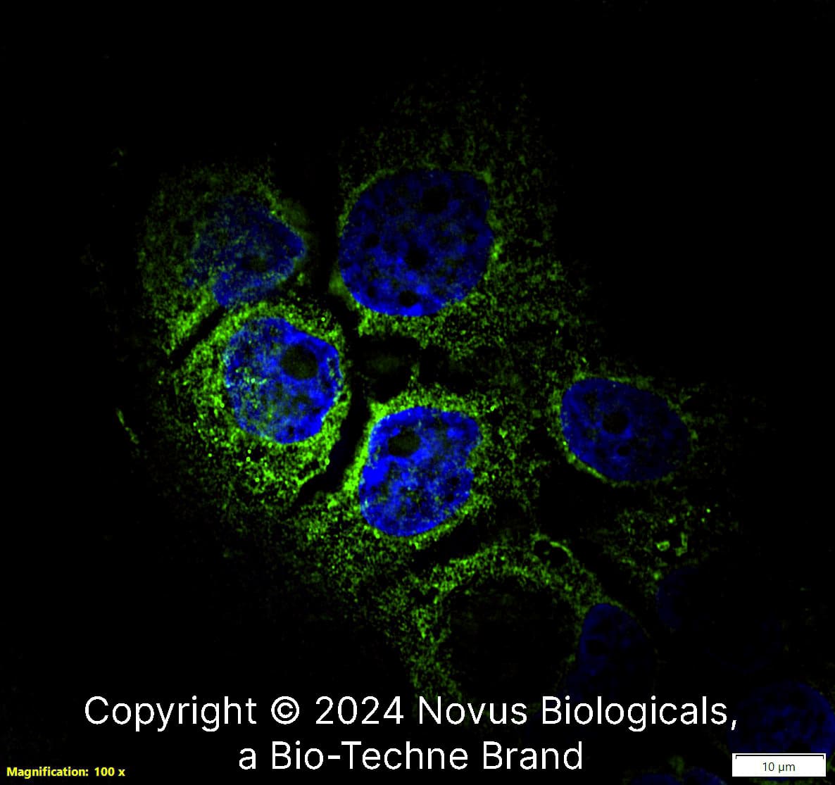 CD68/SR-D1 (KP1) was detected in immersion fixed A431 human skin carcinoma cell line using Mouse anti-CD68/SR-D1 (KP1) Protein-G purified Monoclonal Antibody conjugated to Alexa Fluor® 488 (Catalog # NB100-683AF488) (green) at 10 µg/mL overnight at 4C. Cells were counterstained with DAPI (blue). Cells were imaged using a 100X objective and digitally deconvolved.  