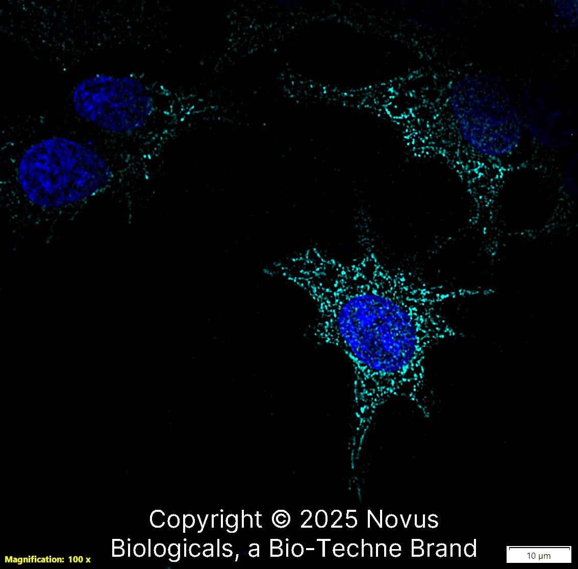 CD68/SR-D1 Antibody (KP1) was detected in immersion fixed HepG2 human hepatocellular carcinoma cell line using Mouse anti-CD68/SR-D1 Antibody (KP1) Protein G Purified Monoclonal Antibody conjugated to Alexa Fluor® 647 (Catalog # NB100-683AF647) (light blue) at 10 µg/mL overnight at 4C. Cells were counterstained with DAPI (blue). Cells were imaged using a 100X objective and digitally deconvolved.  