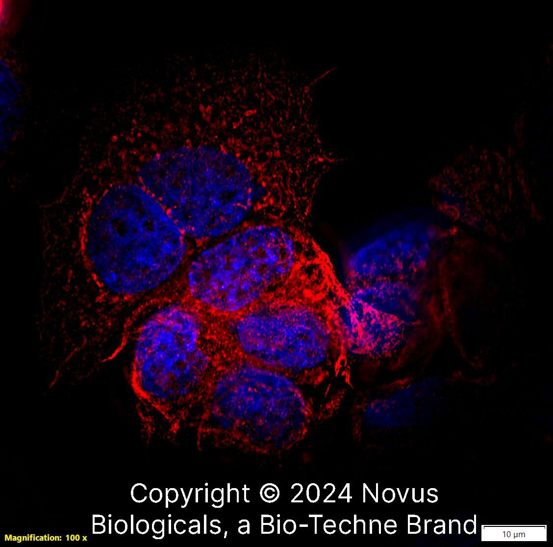 Cytokeratin 19 was detected in immersion fixed MCF7 human breast cancer cell line using Rabbit anti-Cytokeratin 19 Antigen Affinity Purified Polyclonal Antibody conjugated to Biotin (Catalog # NB100-687B) at 5 µg/mL overnight at 4C. Cells were stained using Streptavidin conjugated to DyLight 550 (red) and counterstained with DAPI (blue). Cells were imaged using a 100X objective and digitally deconvolved. 