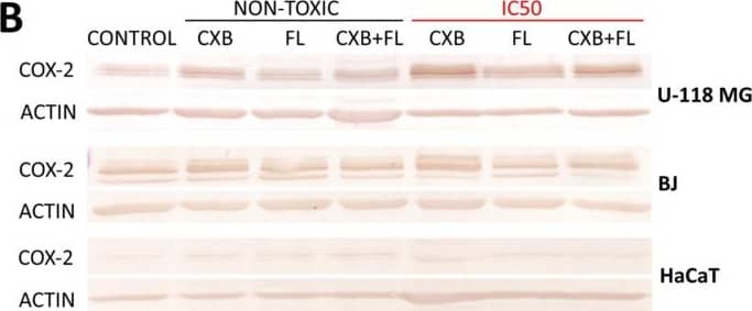 (A) The COX-2 level in U-118 MG, BJ, and HaCaT cells after 24 h treatment with CXB, FL, or CXB+FL mixture at non-toxic concentrations and IC50. Results are presented as medians expressed as percent of non-treated control. The whiskers are lower (25%) and upper (75%) quartile ranges. Symbol * shows statistically significant difference against control, p < 0.05, Kruskal–Wallis test. (B) Image of immunoblots. Image collected and cropped by CiteAb from the following open publication (//www.mdpi.com/1422-0067/25/6/3226), licensed under a CC-BY license. Not internally tested by Novus Biologicals.